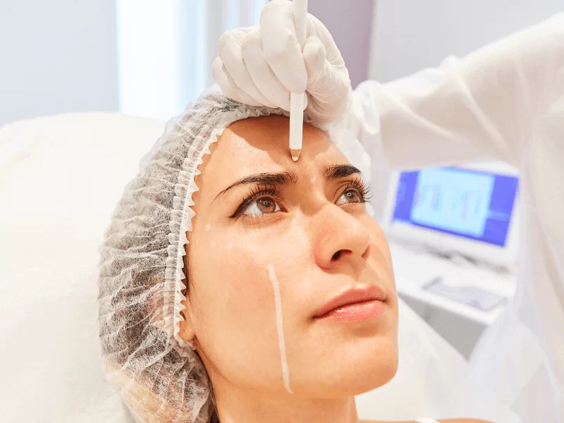 marcação no rosto para tratamento de medicina estética