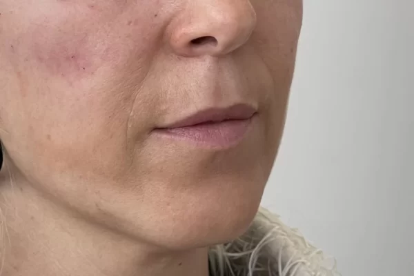 Caso-2.2.jpg Caso-2.2.jpg