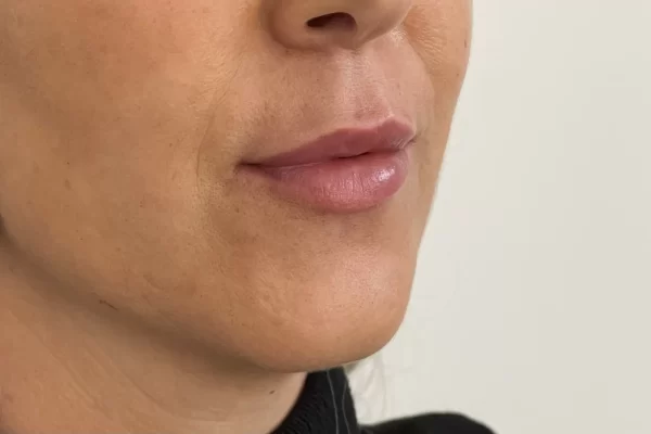 Caso-2.jpg Caso-2.jpg