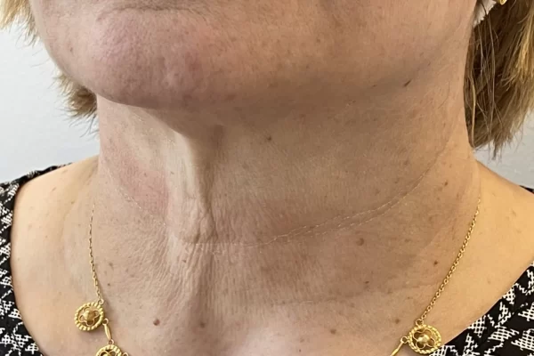 Caso2-antes-2048×1689.jpg Caso2-antes-2048x1689.jpg