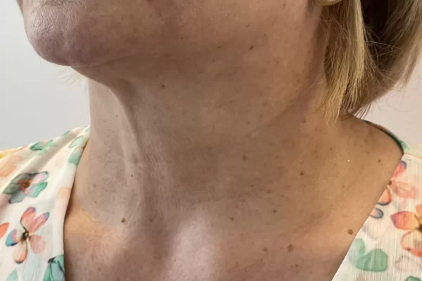 Caso2.2-depois-2048×1660.jpg Caso2.2-depois-2048x1660.jpg