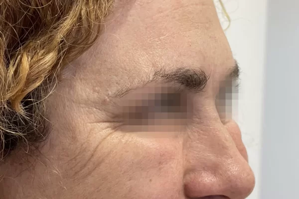 Caso8.8depois_-2048×1676.jpg Caso8.8depois_-2048x1676.jpg