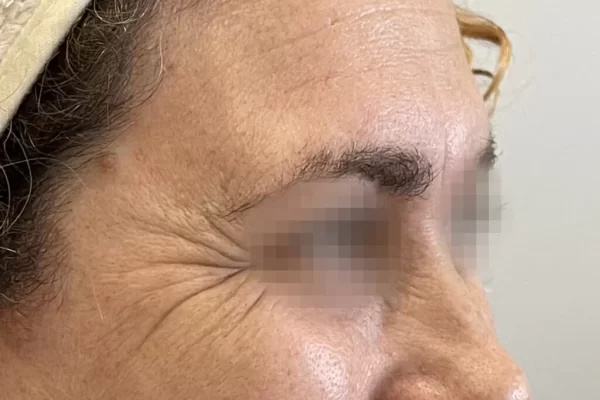 Caso8antes_-1024×957.jpg Caso8antes_-1024x957.jpg