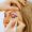Cirurgia_palpebras_planeamento