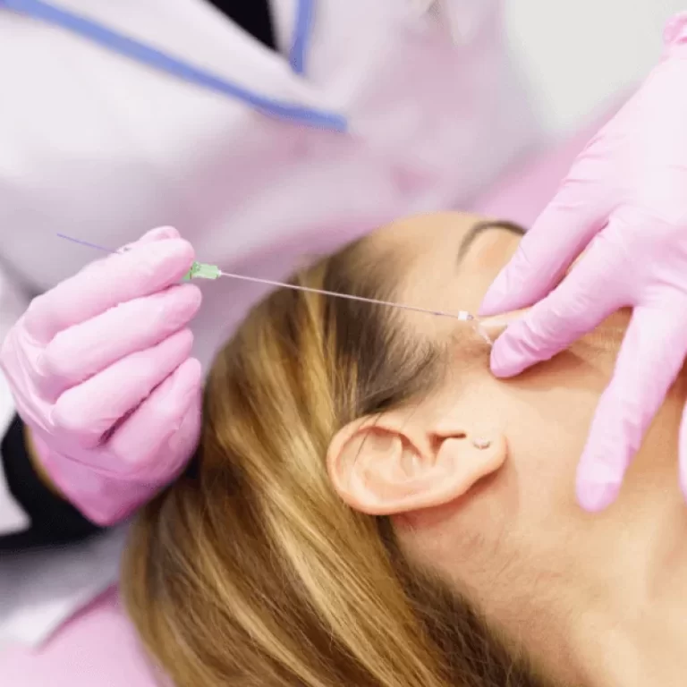 Fios-de-sustentacao-imagem-principal