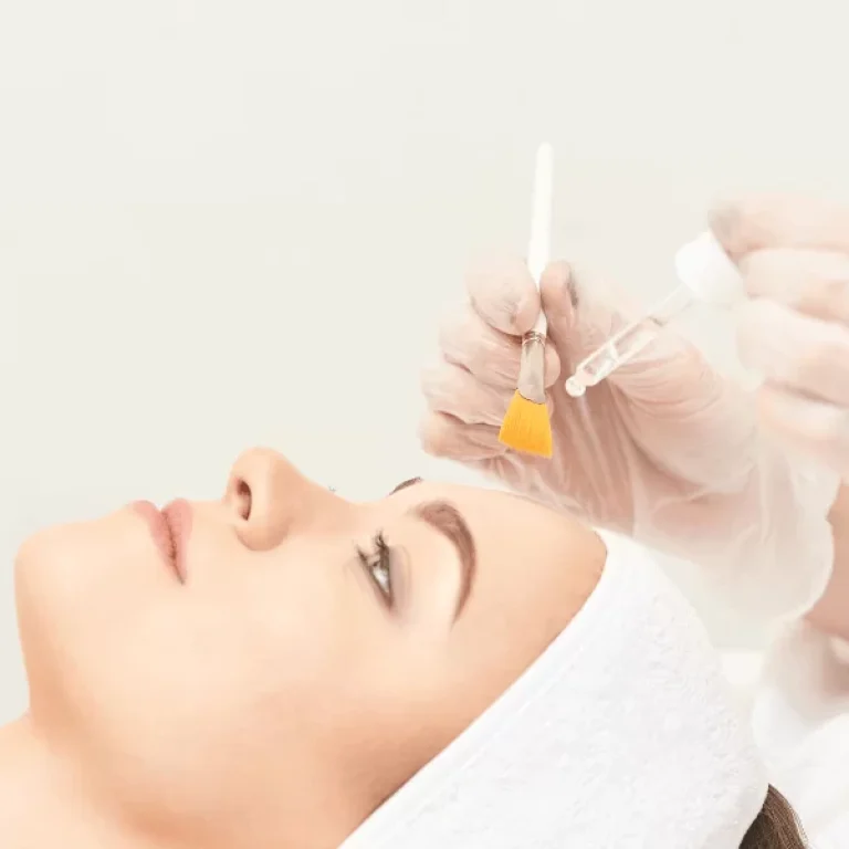 Peeling-Quimico_imagemprincipal