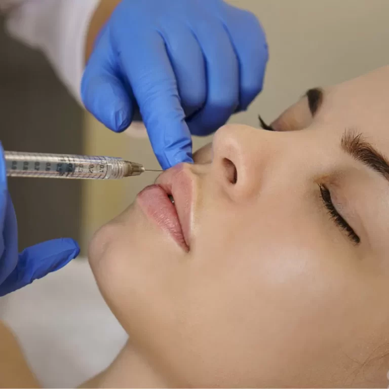 Preenchimento-labial_imagemprincipal