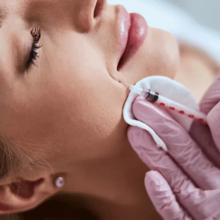 Preenchimento_acido-hialuronico_imagem_principal