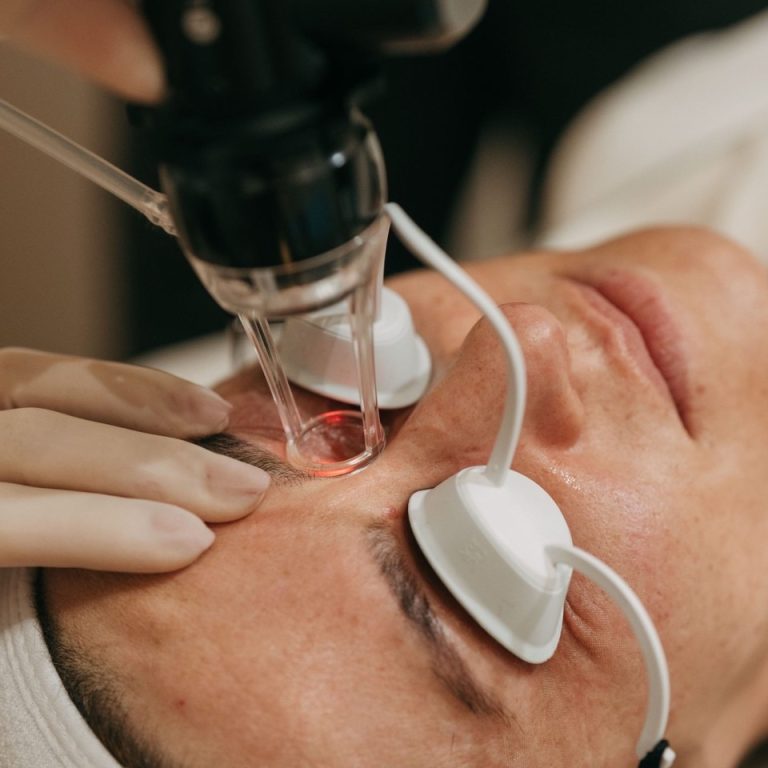 Tratamento com laser CO2 fracionado na MINIMAL Medical, com proteção ocular